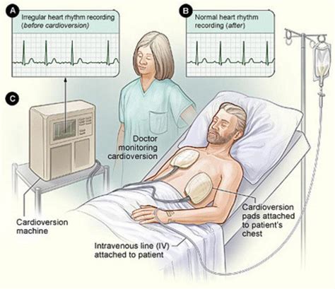 arrhythmia treatment